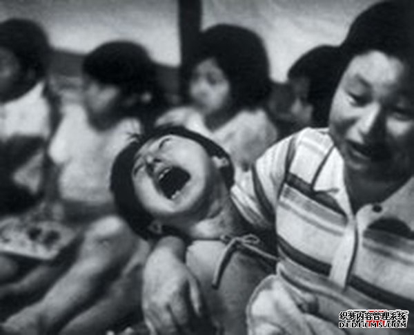 日本水俁病事件,環(huán)境污染導致人們染上“怪病”