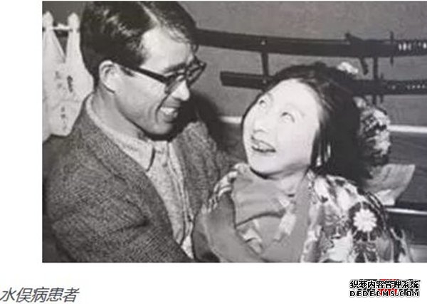 日本水俁病事件,環(huán)境污染導致人們染上“怪病”