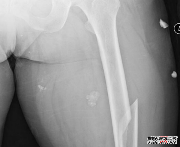 人最痛苦的是什么?揭秘人世間最痛苦的10件事