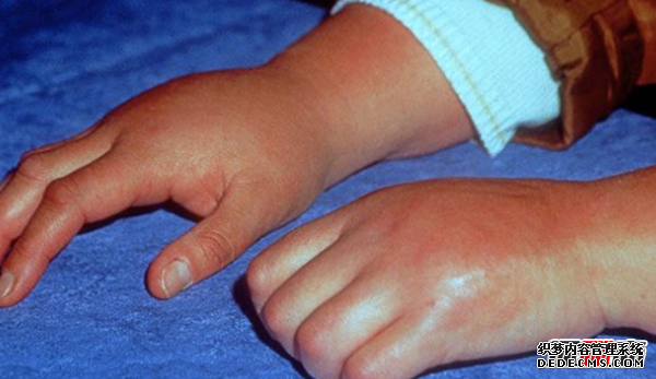 人最痛苦的是什么?揭秘人世間最痛苦的10件事