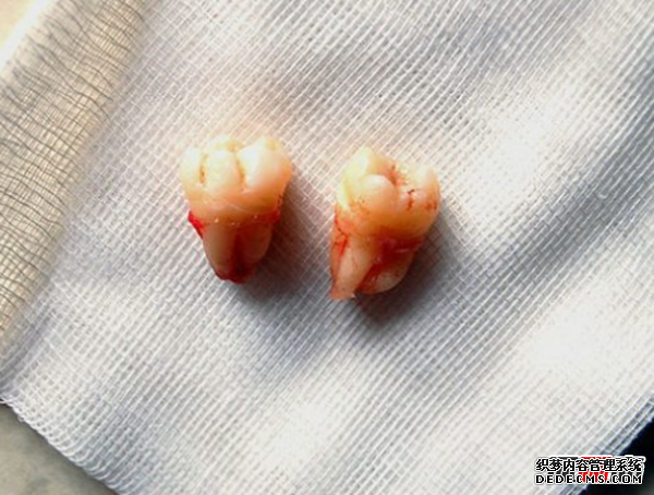 人體有哪些不需要的器官?人類(lèi)不需要的十個(gè)器官(不影響生活)