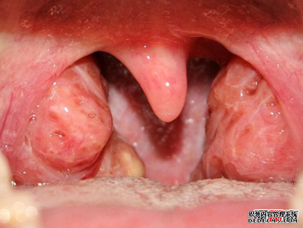 人體有哪些不需要的器官?人類(lèi)不需要的十個(gè)器官(不影響生活)