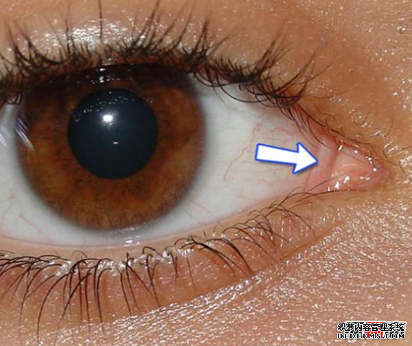 人體有哪些不需要的器官?人類(lèi)不需要的十個(gè)器官(不影響生活)