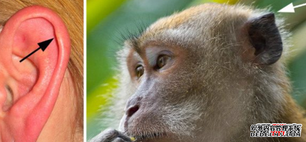 人體有哪些不需要的器官?人類(lèi)不需要的十個(gè)器官(不影響生活)