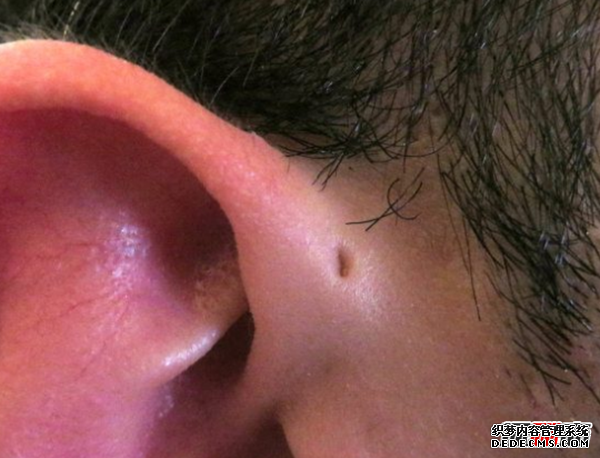 人體有哪些不需要的器官?人類(lèi)不需要的十個(gè)器官(不影響生活)