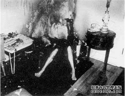 人體自燃之謎：人體自燃是真的嗎 如何才會(huì )產(chǎn)生自燃現象