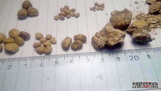 人生最痛苦的事情莫過(guò)于?世界上十大最痛苦的事情