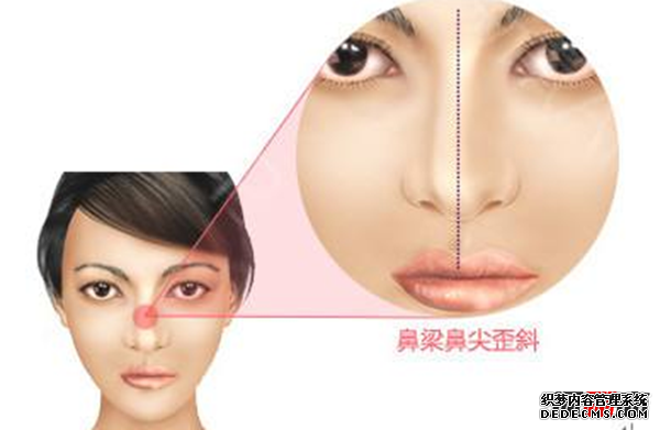 人快死的時(shí)候是什么感覺(jué)?人快死的時(shí)候15個(gè)征兆