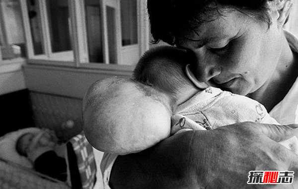 切爾諾貝利現在能去嗎?切爾諾貝利清理人慘狀曝光