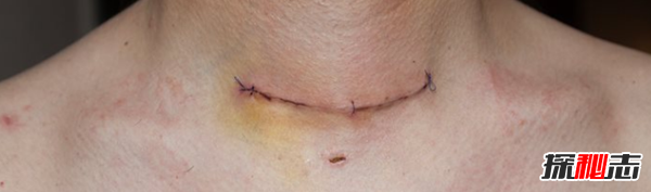 切爾諾貝利現在能去嗎?切爾諾貝利清理人慘狀曝光