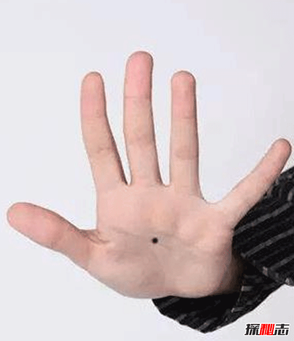 女人痣長(cháng)哪里最有福氣,女人10處有痣是富貴痣