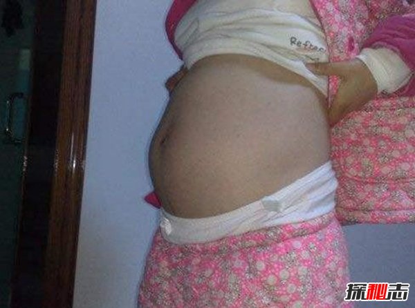 女孩懷孕生20只老鼠 真相太崩潰