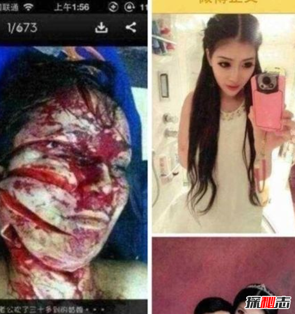 南京富二代殺妻真相,用刀4把傷口多達60多處(附照片)