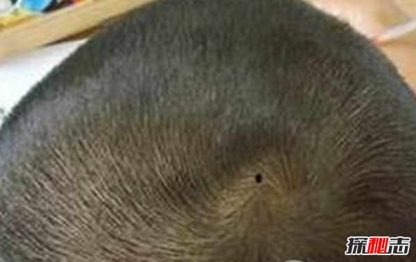 男人哪里長(cháng)痣最有福氣,男人10處有痣是富貴痣