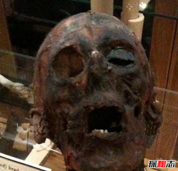 美國穆特博物館肥皂女尸,重口味分分鐘想吐(腐爛女尸成肥皂)