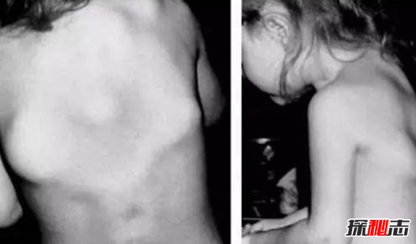 美國穆特博物館肥皂女尸,重口味分分鐘想吐(腐爛女尸成肥皂)