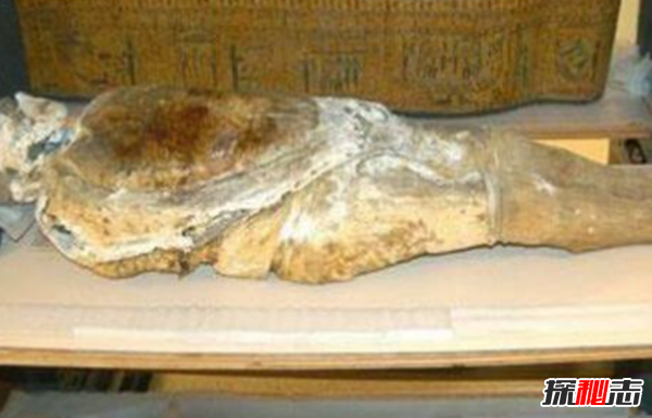 美國穆特博物館肥皂女尸,重口味分分鐘想吐(腐爛女尸成肥皂)