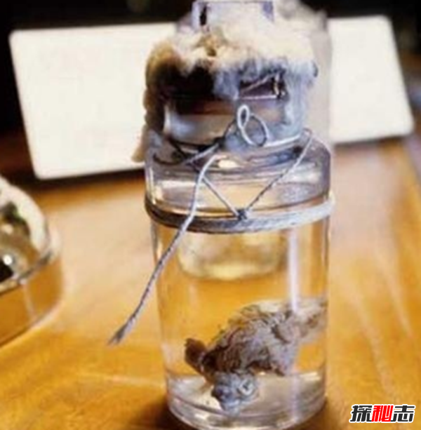 美國穆特博物館肥皂女尸,重口味分分鐘想吐(腐爛女尸成肥皂)