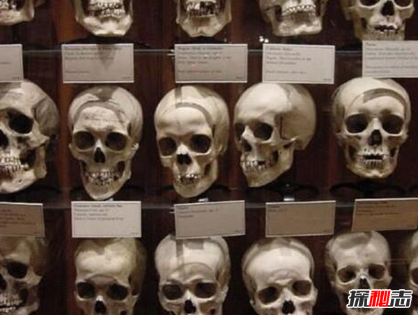 美國穆特博物館肥皂女尸,重口味分分鐘想吐(腐爛女尸成肥皂)