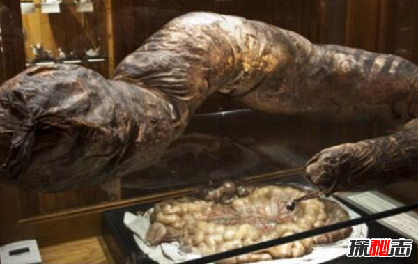 美國穆特博物館肥皂女尸,重口味分分鐘想吐(腐爛女尸成肥皂)
