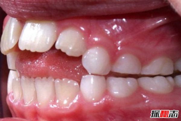 每個(gè)人都有那么點(diǎn)怪癖,盤(pán)點(diǎn)十大真實(shí)恐怖怪癖事件