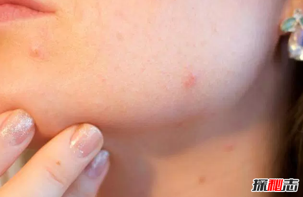 蘆薈有什么妙用?蘆薈的十大功效與作用