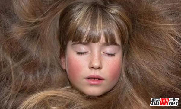 蘆薈有什么妙用?蘆薈的十大功效與作用