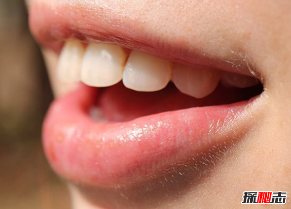 被閃電擊中會(huì )死嗎?十大閃電擊人離奇事件