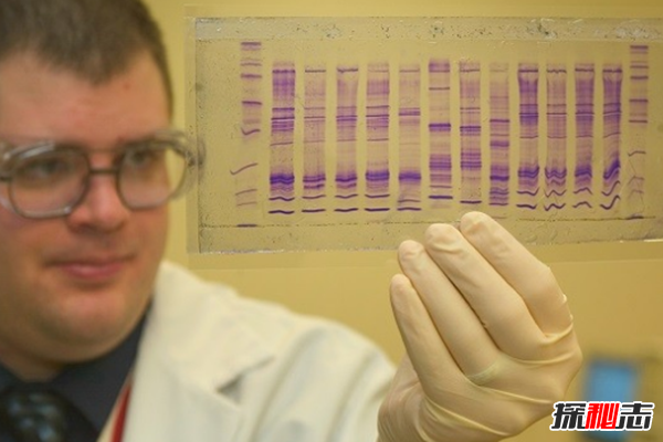 白化病是怎么引起的?關(guān)于白化病的15個(gè)驚人事實(shí)