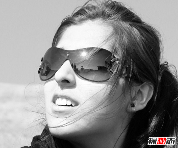 白化病是怎么引起的?關(guān)于白化病的15個(gè)驚人事實(shí)