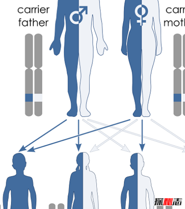 白化病是怎么引起的?關(guān)于白化病的15個(gè)驚人事實(shí)