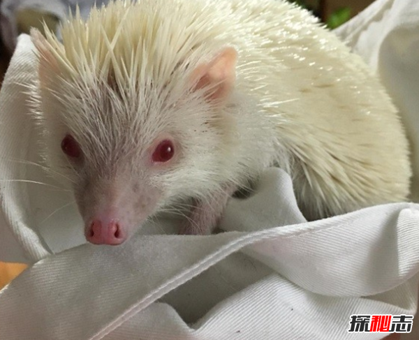 白化病是怎么引起的?關(guān)于白化病的15個(gè)驚人事實(shí)