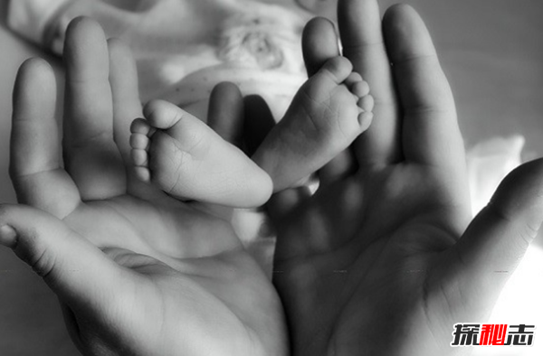 白化病是怎么引起的?關(guān)于白化病的15個(gè)驚人事實(shí)