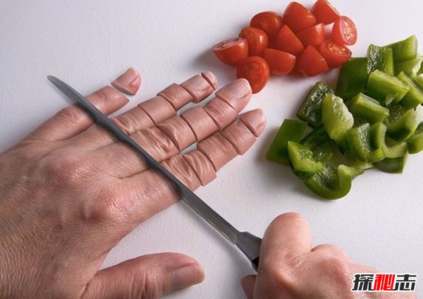 世界上10大最少見(jiàn)的病 恐男癥/自噬綜合癥榜上有名