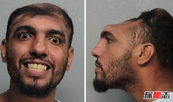 震撼世界的十大怪人 吃飛機/60年不洗澡的人你見(jiàn)過(guò)嗎?