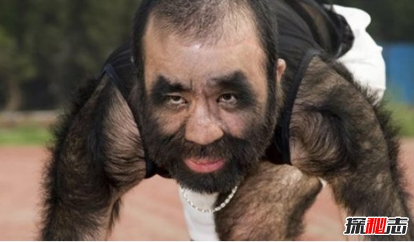震撼世界的十大怪人 吃飛機/60年不洗澡的人你見(jiàn)過(guò)嗎?