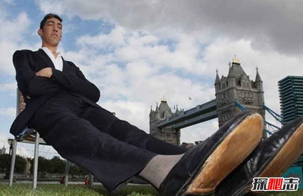 震撼世界的十大怪人 吃飛機/60年不洗澡的人你見(jiàn)過(guò)嗎?