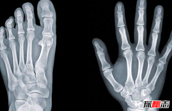 10個(gè)最掙錢(qián)的危險工作 有命賺錢(qián)也要有命花!(需小心)