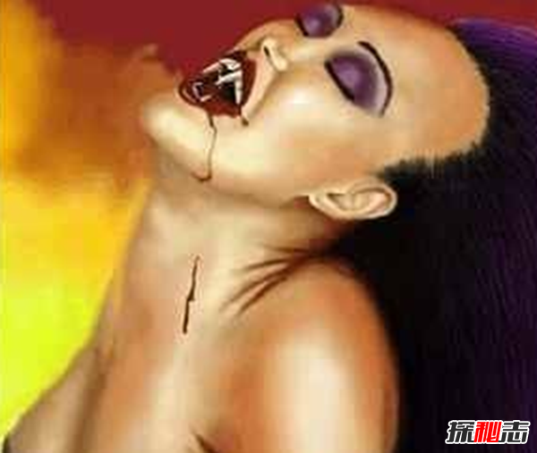 Blaschko斑紋癥是什么?全身長(cháng)滿(mǎn)條紋的罕見(jiàn)怪病