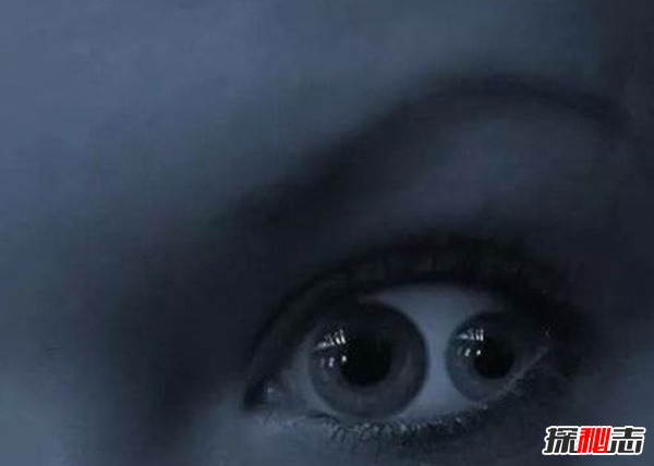 什么是雙瞳孔?世界上有雙瞳孔的人嗎?(中國史書(shū)記載共八人)