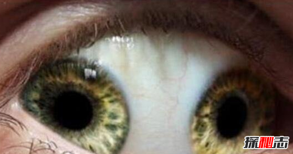 什么是雙瞳孔?世界上有雙瞳孔的人嗎?(中國史書(shū)記載共八人)