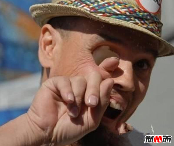 什么是雙瞳孔?世界上有雙瞳孔的人嗎?(中國史書(shū)記載共八人)