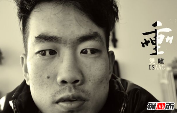 什么是雙瞳孔?世界上有雙瞳孔的人嗎?(中國史書(shū)記載共八人)