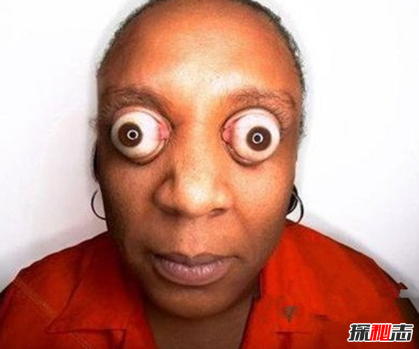 什么是雙瞳孔?世界上有雙瞳孔的人嗎?(中國史書(shū)記載共八人)