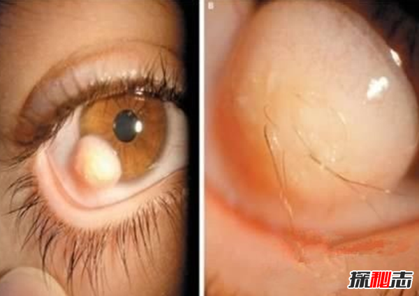 什么是雙瞳孔?世界上有雙瞳孔的人嗎?(中國史書(shū)記載共八人)