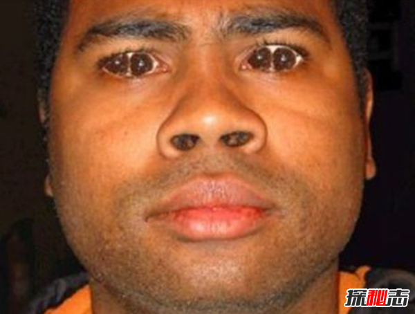 什么是雙瞳孔?世界上有雙瞳孔的人嗎?(中國史書(shū)記載共八人)