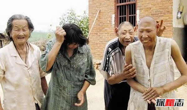 神農架猴娃之謎,百歲母親養育三個(gè)猴娃（近親聯(lián)姻)