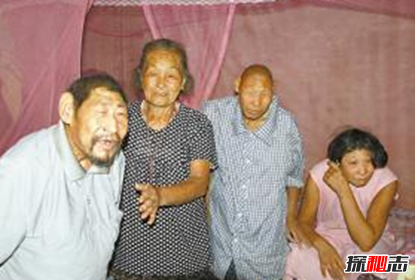 神農架猴娃之謎,百歲母親養育三個(gè)猴娃（近親聯(lián)姻)