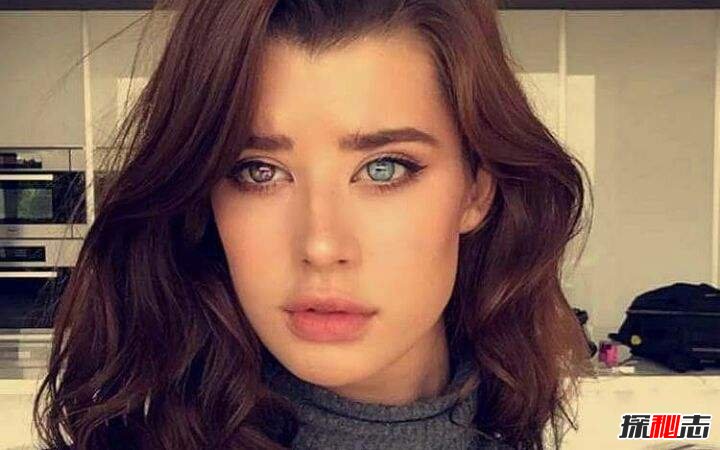 十大世界上最稀有的瞳孔色：你見(jiàn)過(guò)銀色、粉色瞳孔嗎？