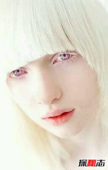 十大世界上最稀有的瞳孔色：你見(jiàn)過(guò)銀色、粉色瞳孔嗎？